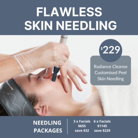 Flawless Skin Needling